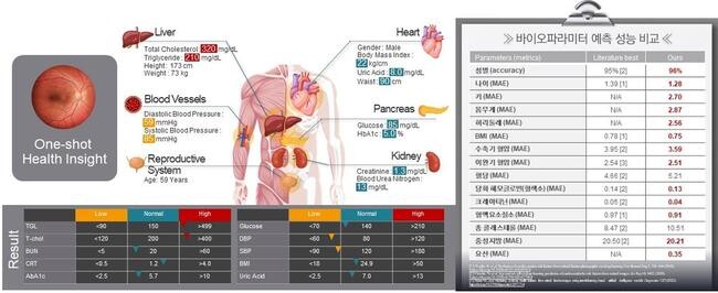경기도 지원 연구진 '안저영상 AI 분석 기술' 확보