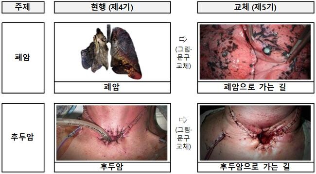 보건복지부는 23일부터 흡연의 위험성을 강조하는 새로운 담뱃갑 경고 그림과 문구를 적용, 궐련과 전자담배의 건강 경고 주제와 표현을 대폭 강화한다고 밝혔다. 제5기 담뱃갑 경고그림 및 문구 표기내용